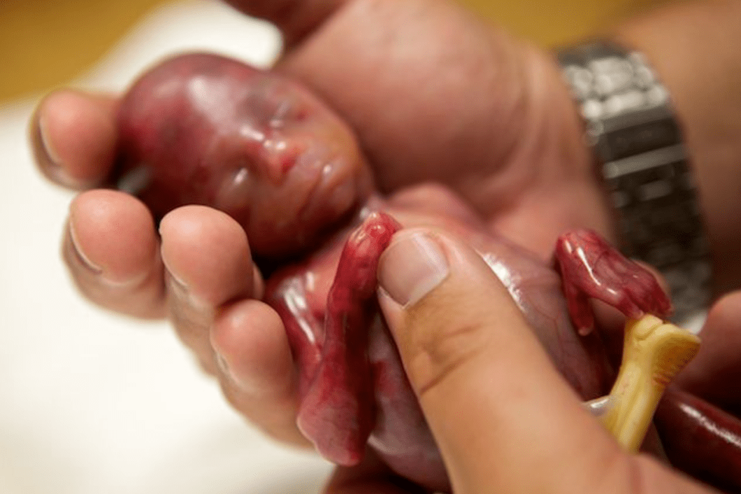 ciudadano-aborto-no-3