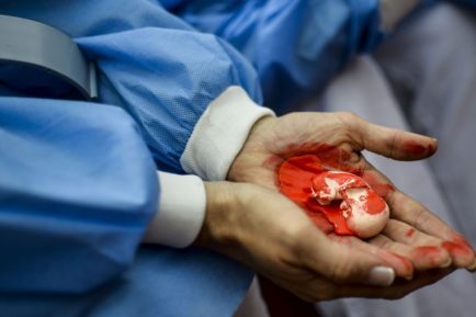 A_UNO_50352728229-1200x800